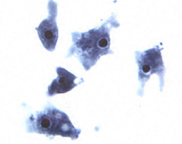 Naegleria Fowleri - Encyclopedia Article - Citizendium