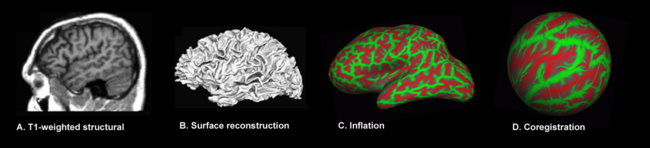 Surface-based Morphometry - Encyclopedia Article - Citizendium