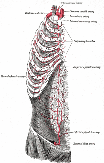 Paracentesis - encyclopedia article - Citizendium