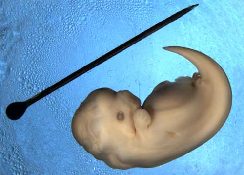 File:Dolphin embryo.jpg