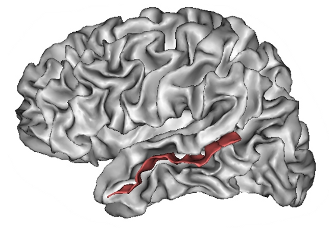 File:Superior temporal sulcus.png