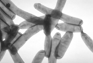 Legionella pneumophila-s.jpg