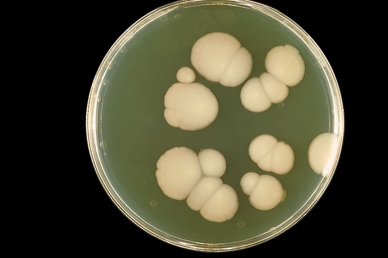 File:800px-Candida albicans PHIL 3192 lores.jpg
