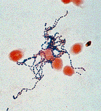 File:GramstainStreptococcuspyogenes.gif