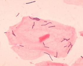 File:Lactobacillus.jpg