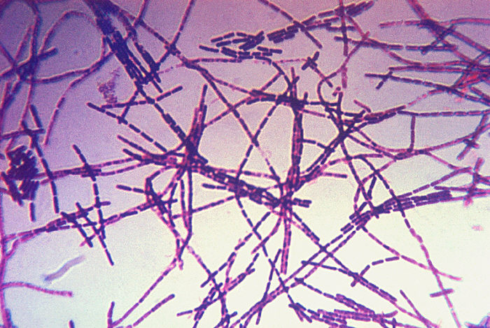 File:Bacillus anthracis Gram.jpg