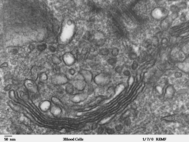 File:Human leukocyte, showing golgi - TEM.jpg
