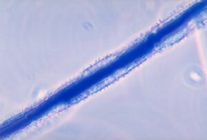 800px-Aspergillus flavus 01.jpg