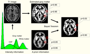Brain morphometry image segmentation.png