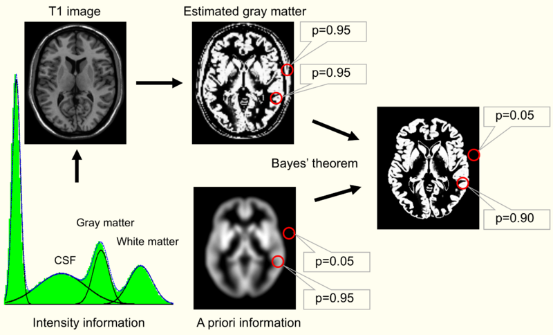 File:Brain morphometry image segmentation.png