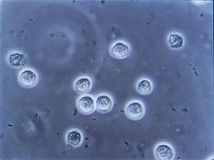 Multiple rod-shaped bacteria between white blood cells of patient with urinary tract infection.jpg