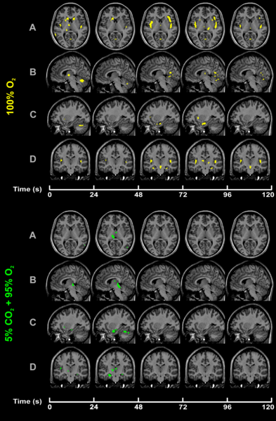 File:CO2-O2-fMRI-all-over-time.png