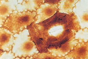 Dicrodium leaf cuticle - MacRae.jpg