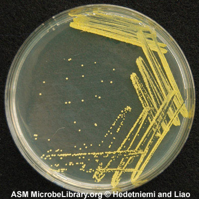 Micrococcus luteus - encyclopedia article - Citizendium