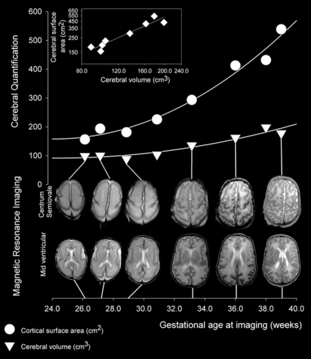 Brain Development - Encyclopedia Article - Citizendium