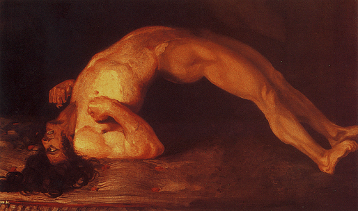 Sir Charles Bell's portrait of a soldier dying of tetanus