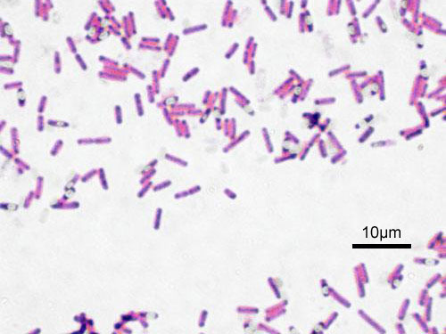 File:Bacillus subtilis Gram.jpg