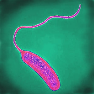 Vibrio cholerae.jpg