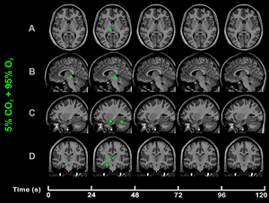 CO2-O2-fMRI-hypercapnic-hyperoxia-over-time.png