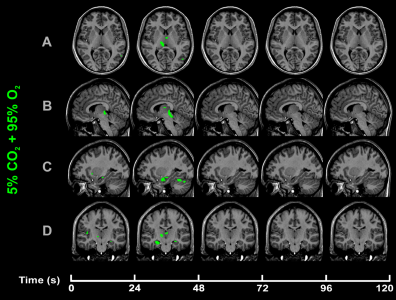 File:CO2-O2-fMRI-hypercapnic-hyperoxia-over-time.png