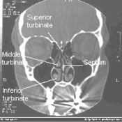 NormalNose-CT-Front-cross-section-common-wiki.jpg