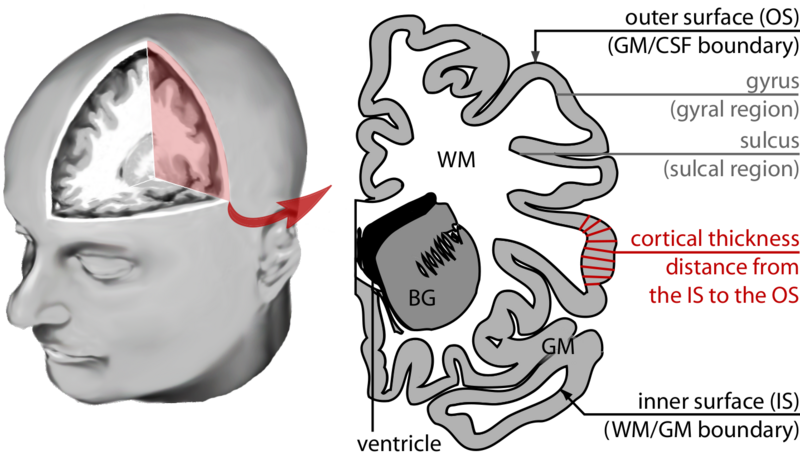 File:Brain morphometry overview.png