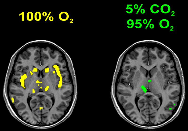 File:CO2-O2-fMRI-A-left.png